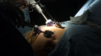Psychological Benefits of Gastric Bypass Surgery